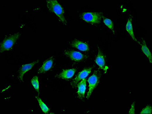 PIK3R4 Antibody - Immunofluorescent analysis of Hela cells using PIK3R4 Antibody at a dilution of 1:100 and Alexa Fluor 488-congugated AffiniPure Goat Anti-Rabbit IgG(H+L)