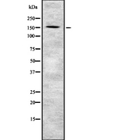 PIK3R4 Antibody - Western blot analysis of PIK3R4 using COLO205 whole cells lysates