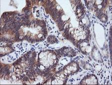 PIK3R5 Antibody - IHC of paraffin-embedded Human colon tissue using anti-PIK3R5 mouse monoclonal antibody.