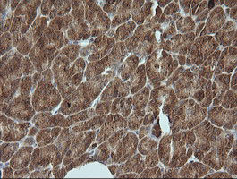 PIK3R5 Antibody - IHC of paraffin-embedded Human pancreas tissue using anti-PIK3R5 mouse monoclonal antibody.