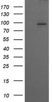 PIK3R5 Antibody - HEK293T cells were transfected with the pCMV6-ENTRY control (Left lane) or pCMV6-ENTRY PIK3R5 (Right lane) cDNA for 48 hrs and lysed. Equivalent amounts of cell lysates (5 ug per lane) were separated by SDS-PAGE and immunoblotted with anti-PIK3R5.