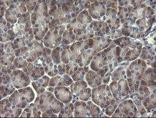PIK3R5 Antibody - IHC of paraffin-embedded Human pancreas tissue using anti-PIK3R5 mouse monoclonal antibody.