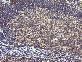 PIK3R5 Antibody - IHC of paraffin-embedded Human tonsil using anti-PIK3R5 mouse monoclonal antibody. (Heat-induced epitope retrieval by 10mM citric buffer, pH6.0, 120°C for 3min).