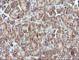 PIK3R5 Antibody - IHC of paraffin-embedded Human pancreas tissue using anti-PIK3R5 mouse monoclonal antibody. (Heat-induced epitope retrieval by 10mM citric buffer, pH6.0, 120°C for 3min).