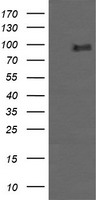 PIK3R5 Antibody - HEK293T cells were transfected with the pCMV6-ENTRY control (Left lane) or pCMV6-ENTRY PIK3R5 (Right lane) cDNA for 48 hrs and lysed. Equivalent amounts of cell lysates (5 ug per lane) were separated by SDS-PAGE and immunoblotted with anti-PIK3R5.