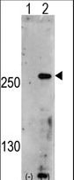PIKFYVE / PIP5K Antibody - Western blot of PIP5K3 (arrow) using rabbit polyclonal PIP5K3 Antibody. 293 cell lysates (2 ug/lane) either nontransfected (Lane 1) or transiently transfected with the PIP5K3 gene (Lane 2) (Origene Technologies).