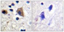 PIKFYVE / PIP5K Antibody - Immunohistochemistry analysis of paraffin-embedded human brain tissue, using PIP5K Antibody. The picture on the right is blocked with the synthesized peptide.