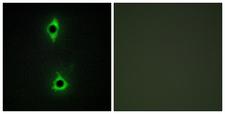 PIKFYVE / PIP5K Antibody - Immunofluorescence analysis of COS7 cells, using PIP5K Antibody. The picture on the right is blocked with the synthesized peptide.