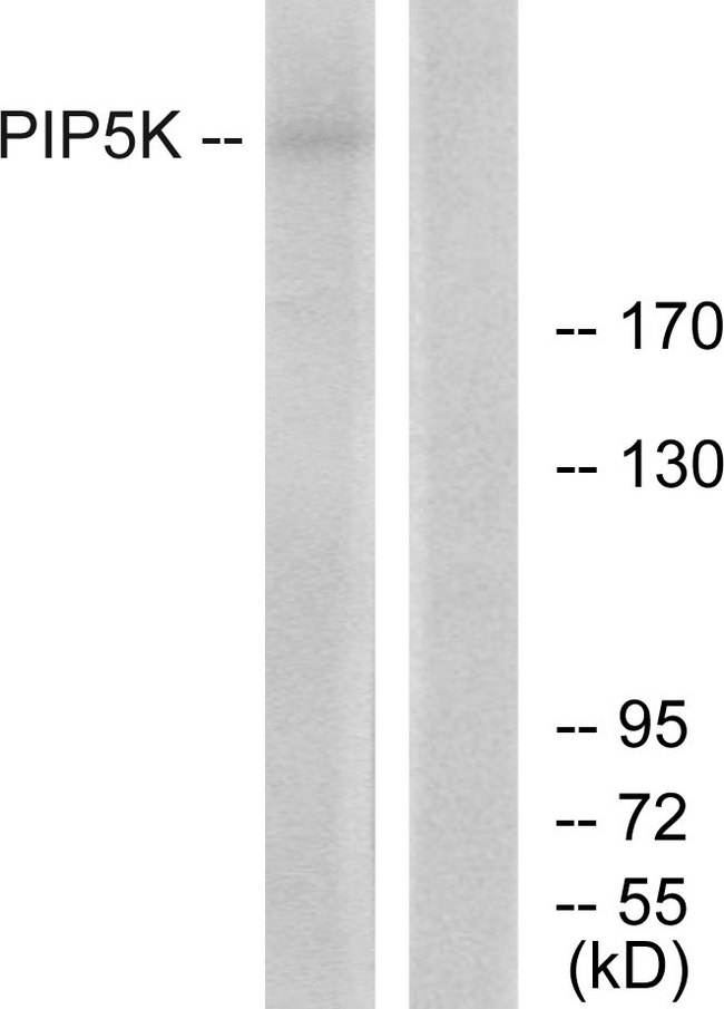 PIKFYVE / PIP5K Antibody - Western blot analysis of lysates from HepG2 cells, using PIP5K Antibody. The lane on the right is blocked with the synthesized peptide.