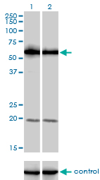 PIKFYVE / PIP5K Antibody - Western blot of PIP5K3 over-expressed 293 cell line, cotransfected with PIP5K3 Validated Chimera RNAi (Lane 2) or non-transfected control (Lane 1). Blot probed with PIP5K3 monoclonal antibody, clone 6C7. GAPDH ( 36.1 kD ) used as specific.