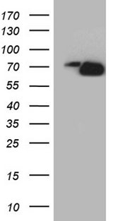 PIKFYVE / PIP5K Antibody - HEK293T cells were transfected with the pCMV6-ENTRY control. (Left lane) or pCMV6-ENTRY PIKFYVE. (Right lane) cDNA for 48 hrs and lysed. Equivalent amounts of cell lysates. (5 ug per lane) were separated by SDS-PAGE and immunoblotted with anti-PIKFYVE. (1:2000)