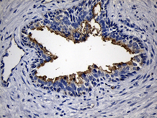 PIKFYVE / PIP5K Antibody - Immunohistochemical staining of paraffin-embedded Human prostate tissue within the normal limits using anti-PIKFYVE mouse monoclonal antibody. (Heat-induced epitope retrieval by 1mM EDTA in 10mM Tris buffer. (pH8.5) at 120°C for 3 min. (1:150)
