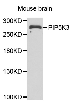 PIKFYVE / PIP5K Antibody - Western blot analysis of extracts of Mouse brain cells.