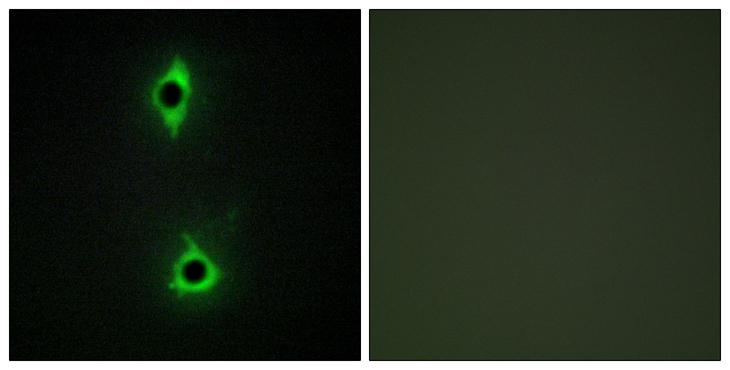 PIKFYVE / PIP5K Antibody - Peptide - + Immunofluorescence analysis of COS7 cells, using PIP5K antibody.