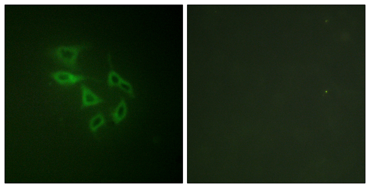 PIKFYVE / PIP5K Antibody - Immunofluorescence analysis of HeLa cells, using PIP5K (Phospho-Ser307) Antibody. The picture on the right is blocked with the phospho peptide.