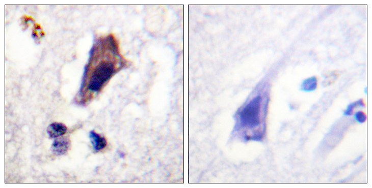 PIKFYVE / PIP5K Antibody - Immunohistochemistry analysis of paraffin-embedded human brain, using PIP5K (Phospho-Ser307) Antibody. The picture on the right is blocked with the phospho peptide.