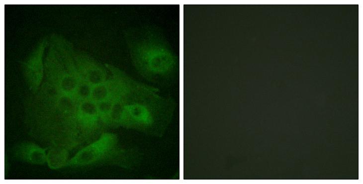 PIKFYVE / PIP5K Antibody - P-peptide - + Immunofluorescence analysis of HeLa cells, using S PIP5K (Phospho-Ser307) antibody.