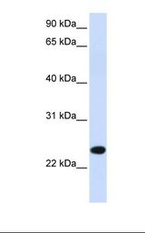 PILRB Antibody - Fetal muscle lysate. Antibody concentration: 1.0 ug/ml. Gel concentration: 12%.  This image was taken for the unconjugated form of this product. Other forms have not been tested.