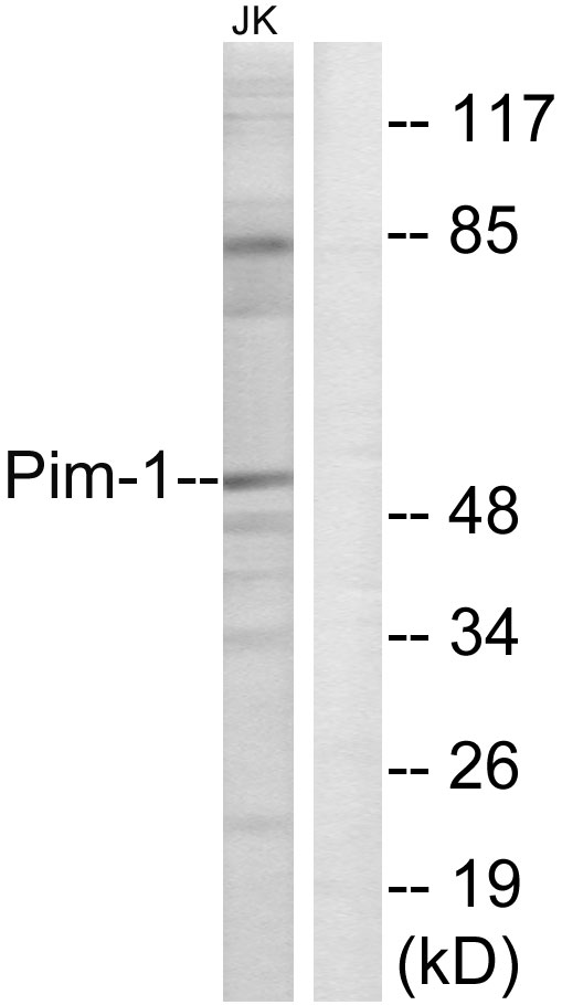 PIM1 / Pim-1 Antibody - Western blot analysis of lysates from Jurkat cells, using Pim-1 Antibody. The lane on the right is blocked with the synthesized peptide.