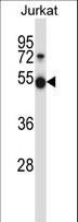 PIM1 / Pim-1 Antibody - Mouse Pim1 Antibody western blot of Jurkat cell line lysates (35 ug/lane). The Pim1 antibody detected the Pim1 protein (arrow).