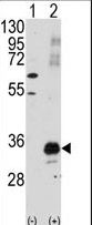 PIM1 / Pim-1 Antibody - Western blot of PIM1 (arrow) using PIM1 Antibody. 293 cell lysates (2 ug/lane) either nontransfected (Lane 1) or transiently transfected with the PIM1 gene (Lane 2) (Origene Technologies).