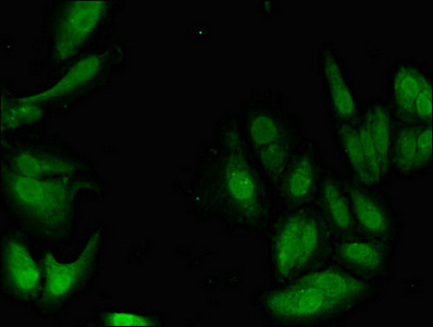PIM1 / Pim-1 Antibody - Immunofluorescent analysis of Hela cells diluted at 1:100 and Alexa Fluor 488-congugated AffiniPure Goat Anti-Rabbit IgG(H+L)