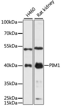 PIM1 / Pim-1 Antibody - Western blot analysis of extracts of various cell lines, using PIM1 antibody at 1:3000 dilution. The secondary antibody used was an HRP Goat Anti-Rabbit IgG (H+L) at 1:10000 dilution. Lysates were loaded 25ug per lane and 3% nonfat dry milk in TBST was used for blocking. An ECL Kit was used for detection and the exposure time was 90s.