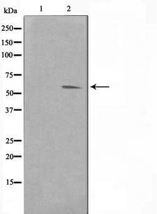 PIM1 / Pim-1 Antibody - Western blot analysis on HuvEc cell lysates using Pim-1 antibody. The lane on the left is treated with the antigen-specific peptide.