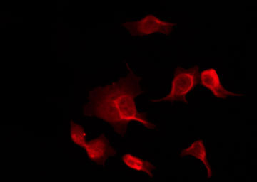 PIM1 / Pim-1 Antibody - Staining HuvEc cells by IF/ICC. The samples were fixed with PFA and permeabilized in 0.1% Triton X-100, then blocked in 10% serum for 45 min at 25°C. The primary antibody was diluted at 1:200 and incubated with the sample for 1 hour at 37°C. An Alexa Fluor 594 conjugated goat anti-rabbit IgG (H+L) Ab, diluted at 1/600, was used as the secondary antibody.