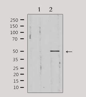 PIM1 / Pim-1 Antibody - Western blot analysis of extracts of mouse brain tissue using Pim-1 antibody. Lane 1 was treated with the antigen-specific peptide.