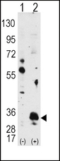 PIM1 / Pim-1 Antibody - Western blot of PIM1 (arrow) using PIM1 Antibody. 293 cell lysates (2 ug/lane) either nontransfected (Lane 1) or transiently transfected with the PIM1 gene (Lane 2) (Origene Technologies).