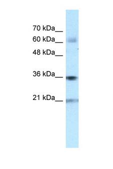 PIM1 / Pim-1 Antibody - PIM1 antibody Western blot of Fetal Heart lysate. Antibody concentration 1 ug/ml. This image was taken for the unconjugated form of this product. Other forms have not been tested.