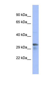 PIM1 / Pim-1 Antibody - PIM1 antibody Western blot of 293T cell lysate. This image was taken for the unconjugated form of this product. Other forms have not been tested.