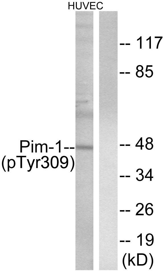 PIM1 / Pim-1 Antibody - Western blot analysis of lysates from HUVEC cells treated with PMA 125ng/ml 30', using Pim-1 (Phospho-Tyr309) Antibody. The lane on the right is blocked with the phospho peptide.