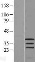 PIM1 / Pim-1 Protein - Western validation with an anti-DDK antibody * L: Control HEK293 lysate R: Over-expression lysate