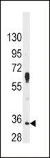 PIM2 / Pim-2 Antibody - Western blot of anti-PIM2 Antibody in HeLa cell line lysates (35 ug/lane). PIM2 (arrow) was detected using the purified antibody.