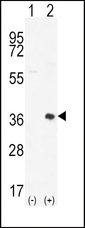 PIM2 / Pim-2 Antibody - Western blot of PIM2 (arrow) using rabbit polyclonal PIM2 Antibody (D292). 293 cell lysates (2 ug/lane) either nontransfected (Lane 1) or transiently transfected (Lane 2) with the PIM2 gene.