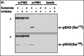 PIM2 / Pim-2 Antibody - PIM proteins were immunoprecipitated from MV4;11 cells and the agarose-protein A-immunoprecipitate complex was tested for its ability to phosphorylate BAD in vitro in the presence or absence of K00135. Phosphorylation of BAD (both on Ser112 and Ser136, detected by WB with phospho-specific antibodies) was abrogated on addition of the compound. Asterisks, strong bands corresponding to the heavy chain of the anti-PIM2 rabbit antibody recognized by the antirabbit immunoglobulin G secondary antibody. Beads alone (without anti-PIM antibodies) were incubated with the MV4;11 extract and used for the same in vitro phosphorylation reaction as a negative control.