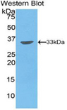 PIM2 / Pim-2 Antibody - Western blot of recombinant PIM2 / Pim-2.  This image was taken for the unconjugated form of this product. Other forms have not been tested.