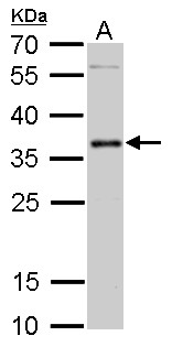 PIM2 / Pim-2 Antibody - PIM2 antibody detects PIM2 protein by Western blot analysis. A. 50 ug mouse testis lysate/extract. 12 % SDS-PAGE. PIM2 antibody dilution:1:500