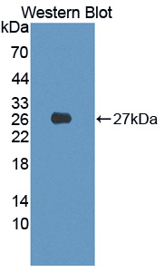 PIM2 / Pim-2 Antibody - Western blot of PIM2 / Pim-2 antibody.