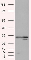 PIM2 / Pim-2 Antibody - HEK293T cells were transfected with the pCMV6-ENTRY control (Left lane) or pCMV6-ENTRY PIM2 (Right lane) cDNA for 48 hrs and lysed. Equivalent amounts of cell lysates (5 ug per lane) were separated by SDS-PAGE and immunoblotted with anti-PIM2.