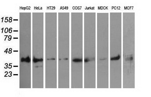 PIM2 / Pim-2 Antibody - Western blot analysis of extracts (35ug) from 9 different cell lines by using anti-PIM2 monoclonal antibody.