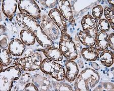 PIM2 / Pim-2 Antibody - IHC of paraffin-embedded Kidney tissue using anti- mouse monoclonal antibody. (Dilution 1:50).