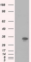 PIM2 / Pim-2 Antibody - HEK293T cells were transfected with the pCMV6-ENTRY control (Left lane) or pCMV6-ENTRY PIM2 (Right lane) cDNA for 48 hrs and lysed. Equivalent amounts of cell lysates (5 ug per lane) were separated by SDS-PAGE and immunoblotted with anti-PIM2.