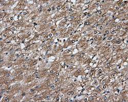 PIM2 / Pim-2 Antibody - Immunohistochemical staining of paraffin-embedded liver tissue using anti- mouse monoclonal antibody. (Dilution 1:50).