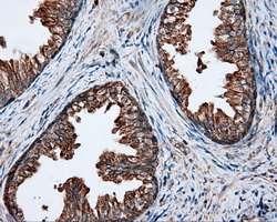 PIM2 / Pim-2 Antibody - Immunohistochemical staining of paraffin-embedded prostate tissue using anti- mouse monoclonal antibody. (Dilution 1:50).