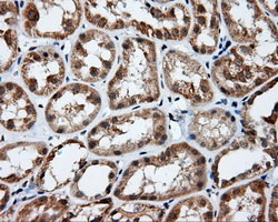PIM2 / Pim-2 Antibody - Immunohistochemical staining of paraffin-embedded Kidney tissue using anti- mouse monoclonal antibody. (Dilution 1:50).