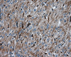 PIM2 / Pim-2 Antibody - IHC of paraffin-embedded liver tissue using anti- mouse monoclonal antibody. (Dilution 1:50).