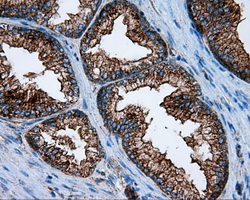 PIM2 / Pim-2 Antibody - IHC of paraffin-embedded prostate tissue using anti- mouse monoclonal antibody. (Dilution 1:50).